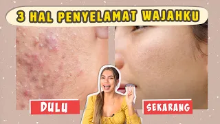 Andai dulu aku tau 3 HAL INI !! Jerawat pasti gak akan balik ⭐️ 🥺