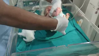 Diaper change Neonatal intensive care unit baby #new #babycry #afterbirth #youtubevideo #trending