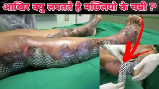 आखिर क्यु लागाते है मछ्लियो के चम्री | Top Very Amazing Fact | इन्हे जानके माजा आजायेगा