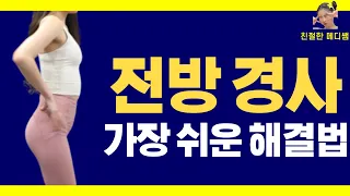 골반 전방경사 가장 쉬운 해결법