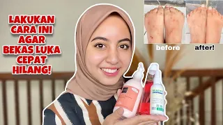 CARA MENGHILANGKAN BEKAS LUKA DI KAKI & TANGAN! | Body care routine