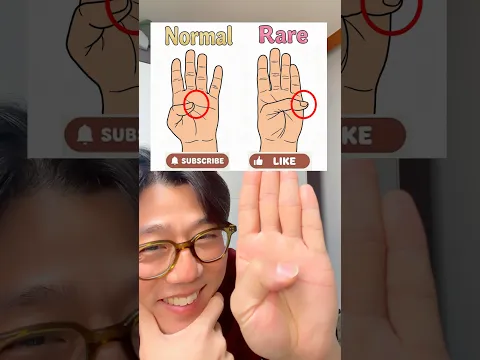 “NORMAL” !! 😅 Are you?
