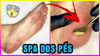 COMO FAZER SPA DOS PÉS EM CASA | Unhas da Lalá
