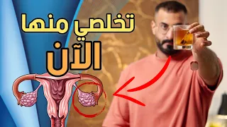 5 عادات سهلة للتخلص من تكيسات المبايض في اسرع وقت