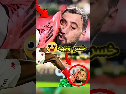 تمزق وجهه 😳 قصة أسوأ اصابة بتاريخ كرة القدم ⚽️❌️ #shorts