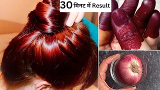 प्याज़ के रस से बालों को Brown Color करने का ये तरीक़ा आपको किसी ने भी बताया होगा| बाल लंबे भी होंगे