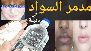 عشرينيه تقسم نصحنى به طبيب جزائري كان وجهي مدمر سواد والتهاب أصبح ابيض من الثلج وكل من رأى وجهي تعجب