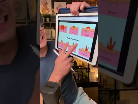 Как избавиться от ПАПИЛЛОМ ?!