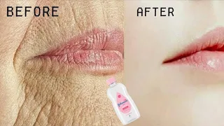 Remove WRINKLES Overnight, Magical Remedy to Remove WRINKLES, Fine Lines Permanently ll NGWorld