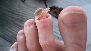 THIS was eating my toes...