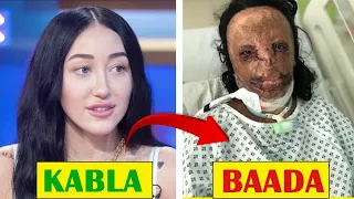 WANAJUTA: Tazama Kilichowapata Baada Ya Kumkufuru Mungu Kwa Kufanya Plastic Surgery