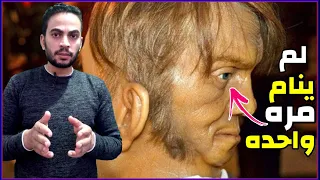 لم يرتاح يوماً في حياته وأنتشرت قصته في كل العالم وعرضوا جمجمته في أحد المتاحف