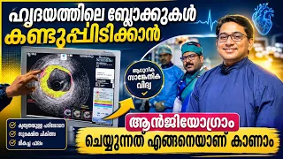 ഹൃദയത്തിലെ ബ്ലോക്കുകൾ കണ്ടുപിടിക്കാൻ, ആൻജിയോഗ്രാം ചെയ്യുന്നത് കാണാം | Angiogram Malayalam video