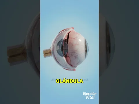 Por Qué Aparece El Ojo De Cereza😱