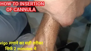 How to insert cannula?, वीगो कैसे लगाये?, cannula लगाने का सही तरीका, iv cannula #cannula 