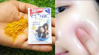 Shampoo मे बस यह चीज़ मिलालो चेहरे का पुराने से पुराना कालापन,मैल, दाग धब्बे को दूर करने का  तरीका