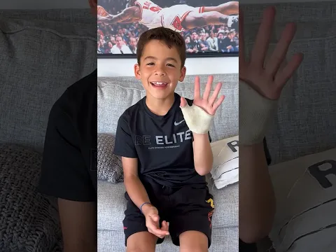 I BROKE MY FIRST BONE...