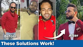 Top 5 Hair Loss Solutions That ACTUALLY WORK | Hair Loss Treatment For Men | Be Ghent