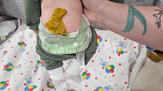 Huge Diaper Blowout!! Poop Explosion for silicone baby doll| nlovewithreborns2011