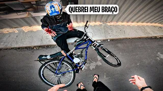 MEU IRMÃO SOFREU UM ACIDENTE GRAVE DE BIKE MOTORIZADA!