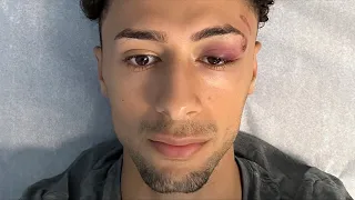 $5 = 1 Backflip