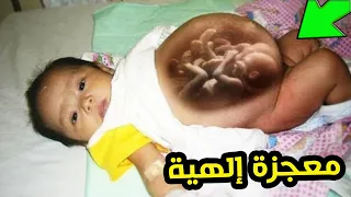 أم حامل أنجبت طفلة رضيعة حامل كيف ذلك؟ قصة حيرت العلماء 😱