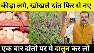 दांत में दर्द, दांत में लगा कीड़ा, खोखला दांत फिर से नए जैसा | Remedy For Tooth Cavity | Dr Bhushan