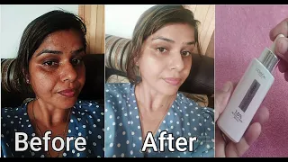 L'Oréal Paris Glycolic Bright Range 2 Weeks Review with Before & After|Glycolic Bright Honest Review