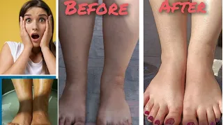 सिर्फ एक बार में parlour से बेहतर feet whitening+tan removal /Pedicure at home / Pedicure