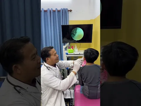 When ENT Doctors Get the Job Done Right! ✅🧼 #SatisfyingRemoval #DoctorView