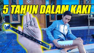KECELAKAAN 2018 PATAH TULANG & LEPAS PEN 2023