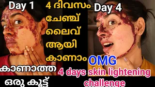 നിറം വക്കണം എന്നുള്ളവർക്കും വിവാഹത്തിന് ഒരുങ്ങുന്നവർക്കും റിസൾട്ട്‌ കിട്ടുന്ന ഒരു പുതിയ കൂട്ട് #skin