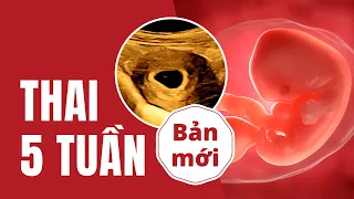 Thai 5 Tuần Tuổi Như Thế Nào? Có Tim Thai Chưa? Siêu Âm Thai 5 Tuần
