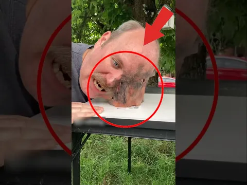 What’s Happening to His Face?! 😱