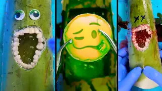 Why Did The End Make Me Cry? 😭🤧💔 Top 10 Food Surgeries