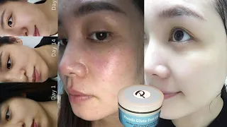 Preeda Gluta Fast Cream | Inspired By Plastic surgeon | Pigmentation | Dark Spots | Skin Whitening