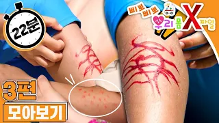 [EBS놀이터]❗️삐뽀삐뽀 우리 몸 X파일❗️｜해파리에 쏘였어요｜진드기에 물렸어요｜풀독이 올랐어요｜3편 모아보기｜25분 연속보기