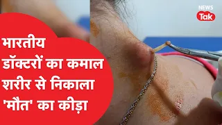 Ghazab Ho Gaya: जो अमेरिका में नहीं हो पाया वो दिल्ली के डॉक्टरों ने कर दिखाया!