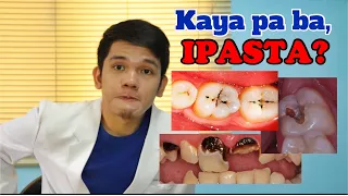 PASTA or TOOTH FILLING: Kaya pa ba?