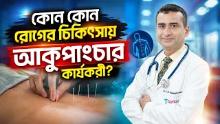 আসুন জেনে নিই কোন কোন রোগের চিকিৎসায় আকুপাংচার কার্যকরী?