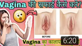 योनि की रोज़ाना देखभाल कैसे करें?/ Everyday Vaginal Health Care Routine  private part whitening