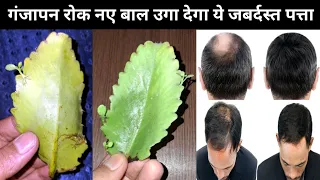 ganjapan dur karne ke upay | hair growth home remedies | hair fall treatment/गंजापन दूर करने के उपाय