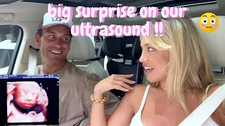 we saw something unexpected at our ultrasound | VLOG