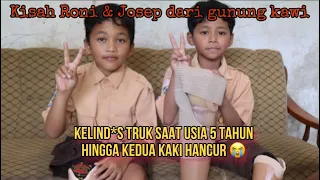 Roni & Josep bisa tersenyum dengan kaki barunya 😇 #caringiscure #kakipalsu #orangbaik