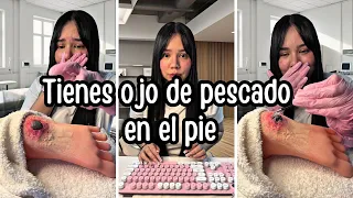Ojo de pescado en el pie 🦶🏼 ASMR de doctora Role Play #asmrdoctor