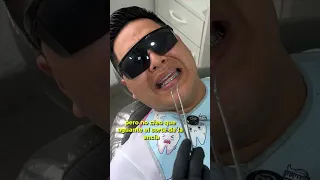 Estas horribles sensaciones sentirás al sacarte la muela del juicio #dientes #dentista #tips