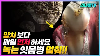 양치보다 매일 먼저하면 잇몸병 사라지고 잇몸이 튼튼해져요!