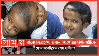 ৪৮ বার অপারেশন শেষে বাড়ি গেলো 'জোড়ামাথার' রাবেয়া-রোকেয়া ! | Conjoined Twins | Somoy TV