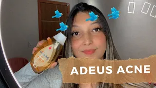 Como acabar com as ACNES 💁🏻‍♀️ ( leiam a descrição)