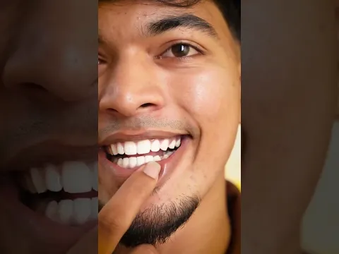Teeth whitening remedies | Follow and comment for Link.